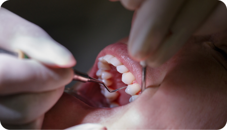 Periodoncia